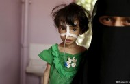 اطفال اليمن الخاسر الأكبر في حرب الأخوة الأعداء